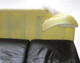 before_and_after_gallery_15